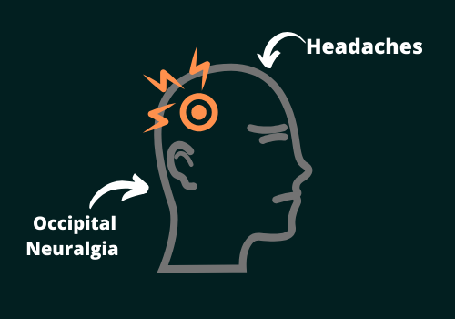 Headache And Occipital Neuralgia- Know The Difference
