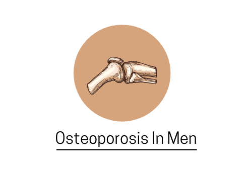 osteoporosis in men